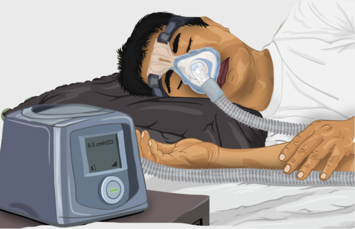 CPAP machine 