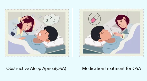 drug treatment-OSA
